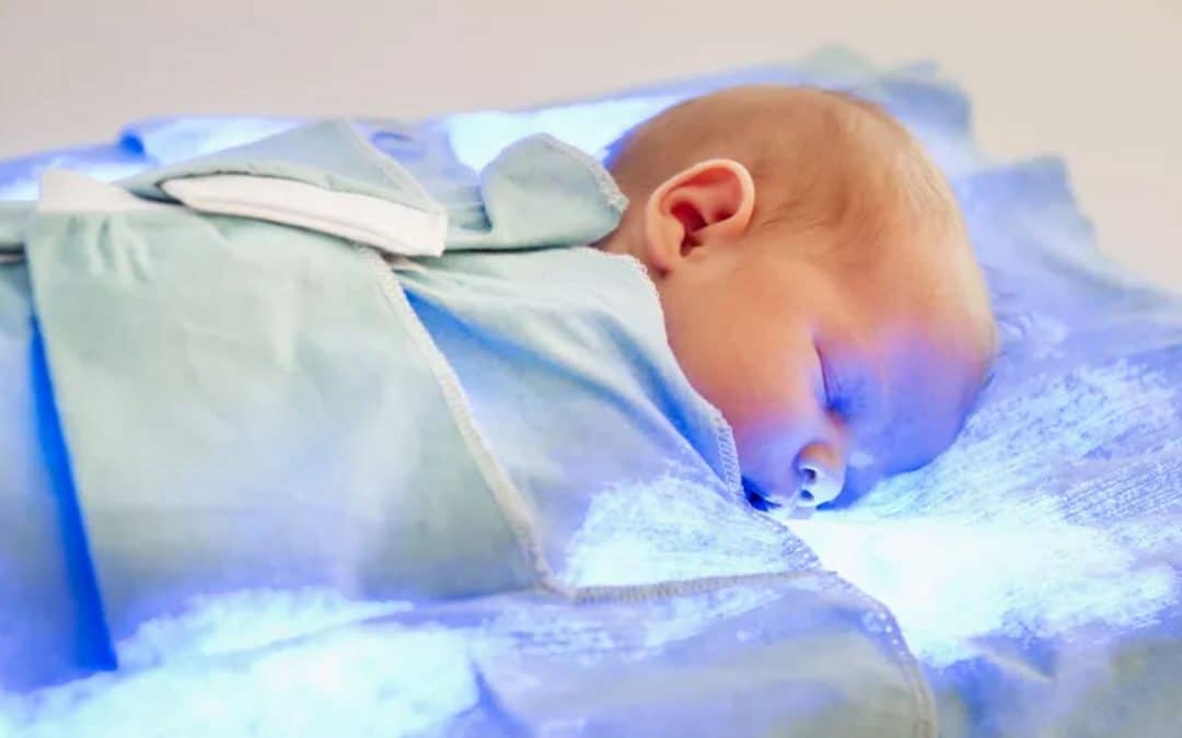 Why Do Babies Have Jaundice?